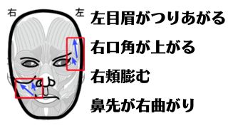 左目と左眉がつりあがって、右口角が上がり左が下がる。右頬膨らみ左がシュッ。鼻先が右側に曲がる。ほとんどのパーツに歪みがある。